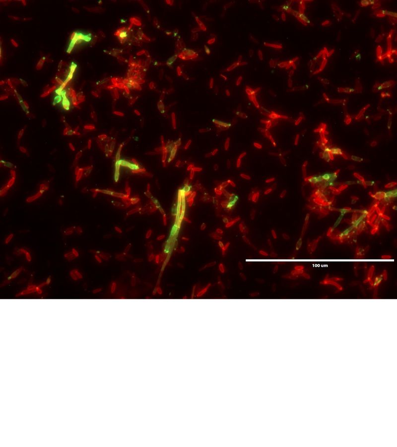 Microscopia de fluorescência do fungo dimórfico Sporothrix schenckii ATCC MYA 4820 (7 dias de cultivo a 37ºC, predominância de leveduras) para identificação de polissacarídeos expostos na parede celular. A marcação foi realizada com WGA-Alexa Fluor 488 (verde), para identificação de resíduos de N-acetilglucosamina, e com ConA-Alexa Fluor 594 (vermelho), para identificação de resíduos de manose. Autora: Julia Marcondes Figueiredo