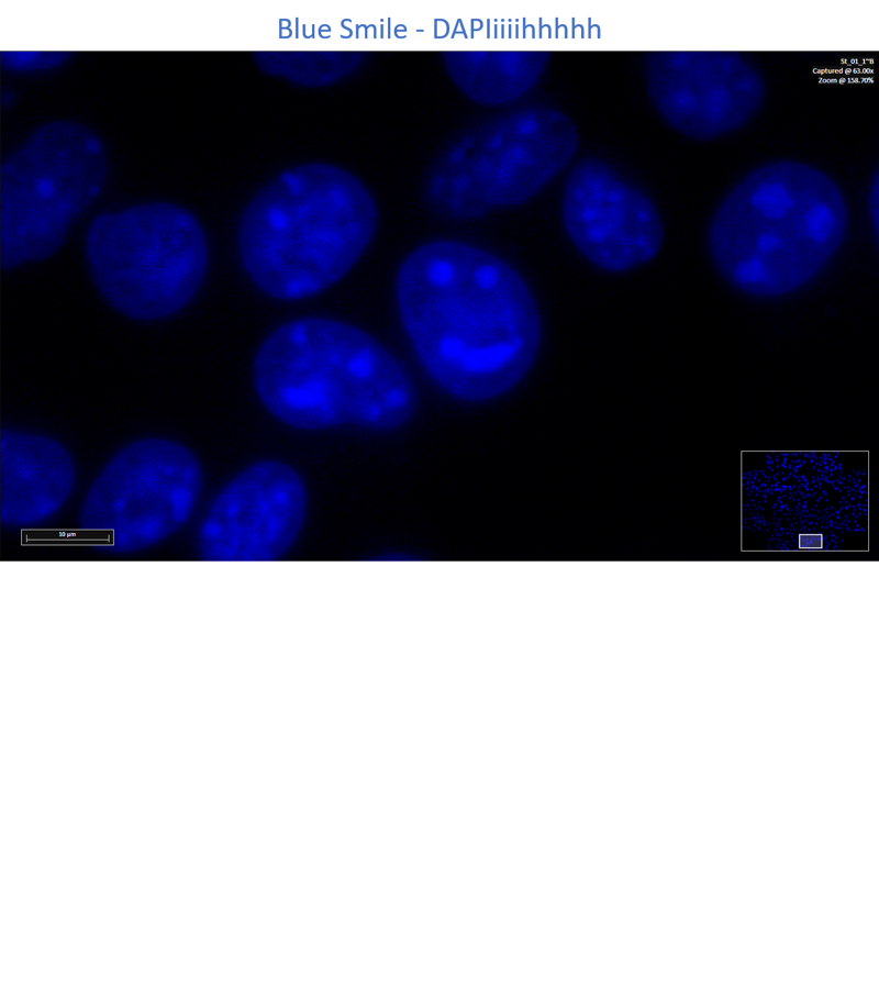 Celúlas B16-F10, marcadas com DAPI e analisadas no Microscópio Confocal A1R MP+ Nikon. Autora: Stellee Marcela Petris Biscaia